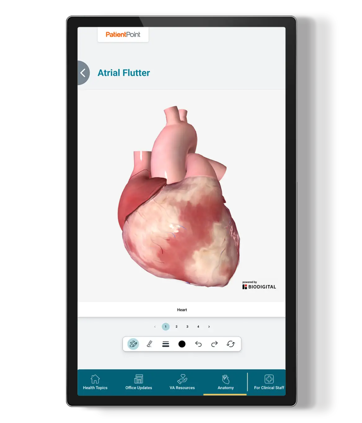 Exam room screen displaying a 3D digital model of a human heart labeled Atrial Flutter, with navigation and anatomy menu options.